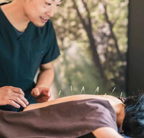 Akupunktur - Traditionellen Chinesischen Medizin (TCM)
